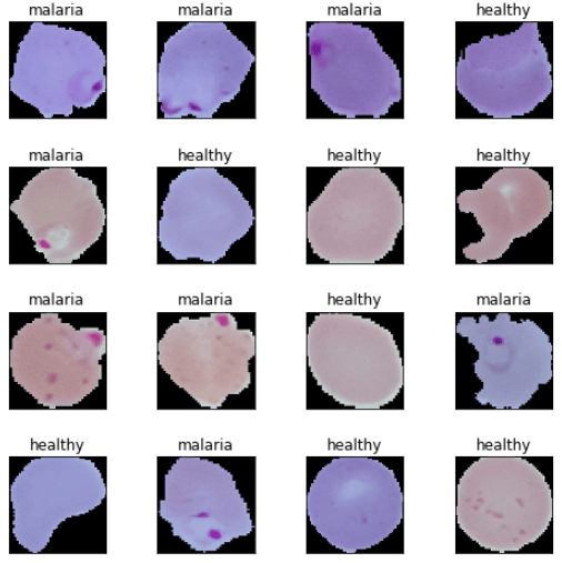 Malaria cell samples Malaria cell samples